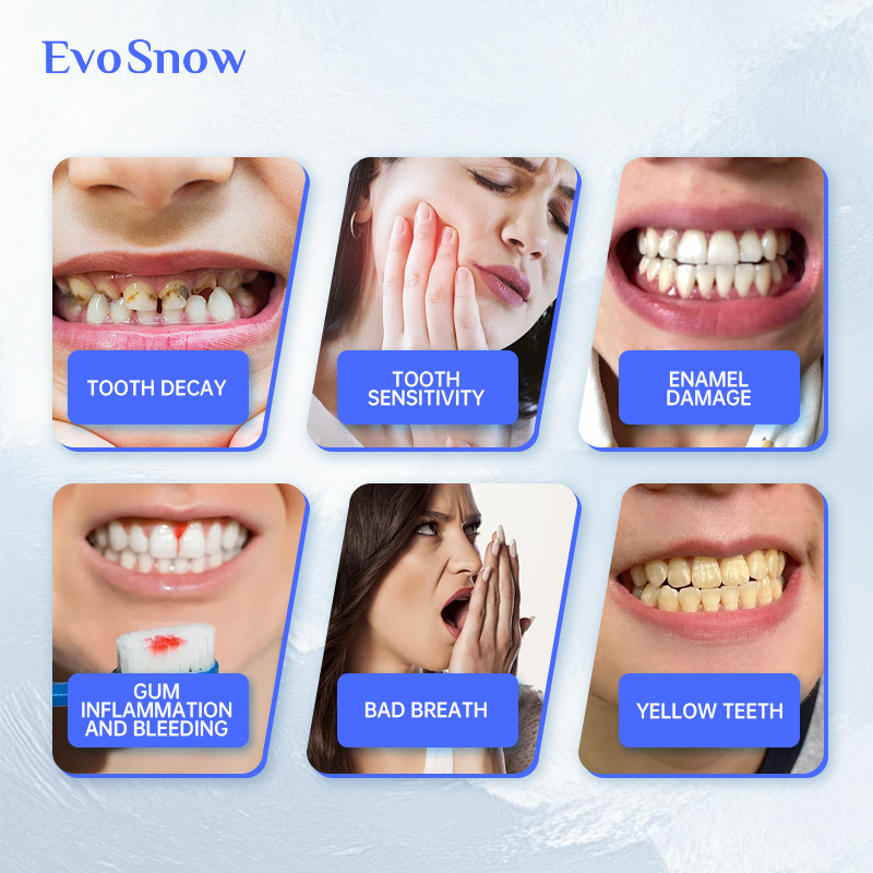 EvoSnow 10% HAP Toothpaste 100g Blueberry Mint | Enamel Repair, Whitening, Sensitivity Fresh Breath